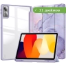Чехол с прозрачной задней крышкой для Xiaomi Redmi Pad SE (фиолетовый мрамор), прозр. акрил